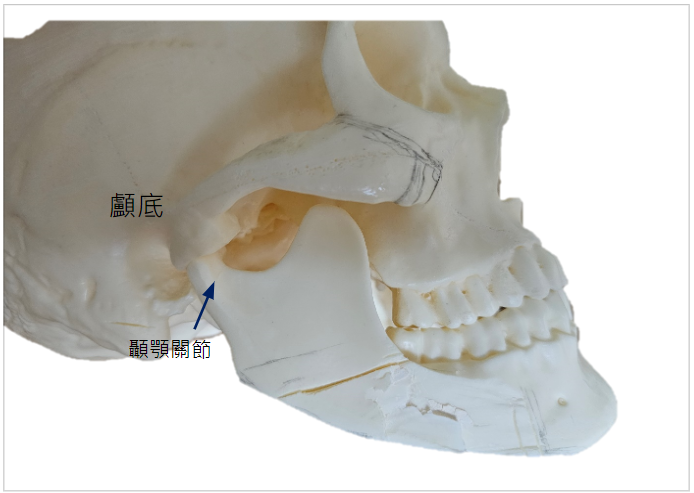 顳顎關節骨折1