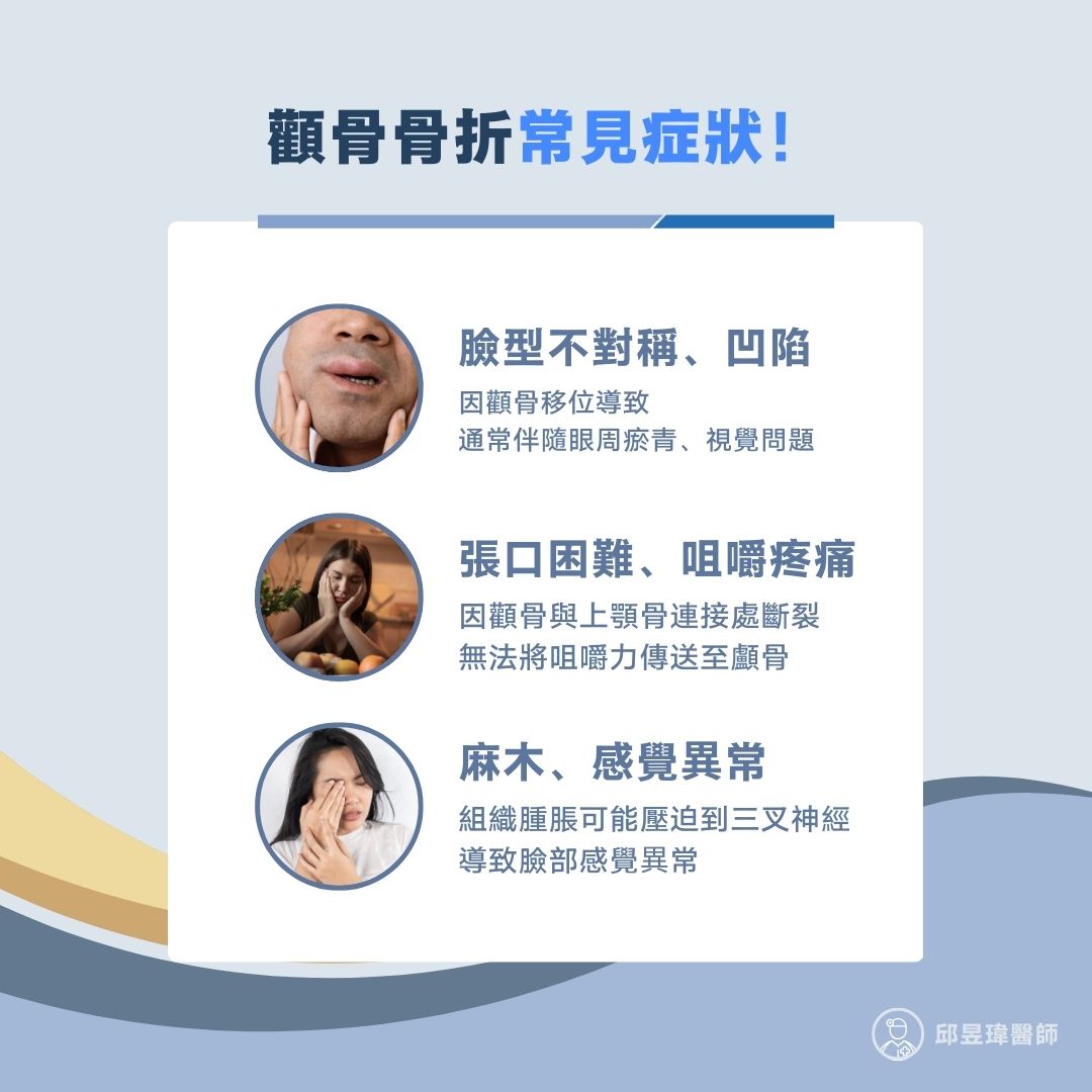 顴骨骨折常見症狀