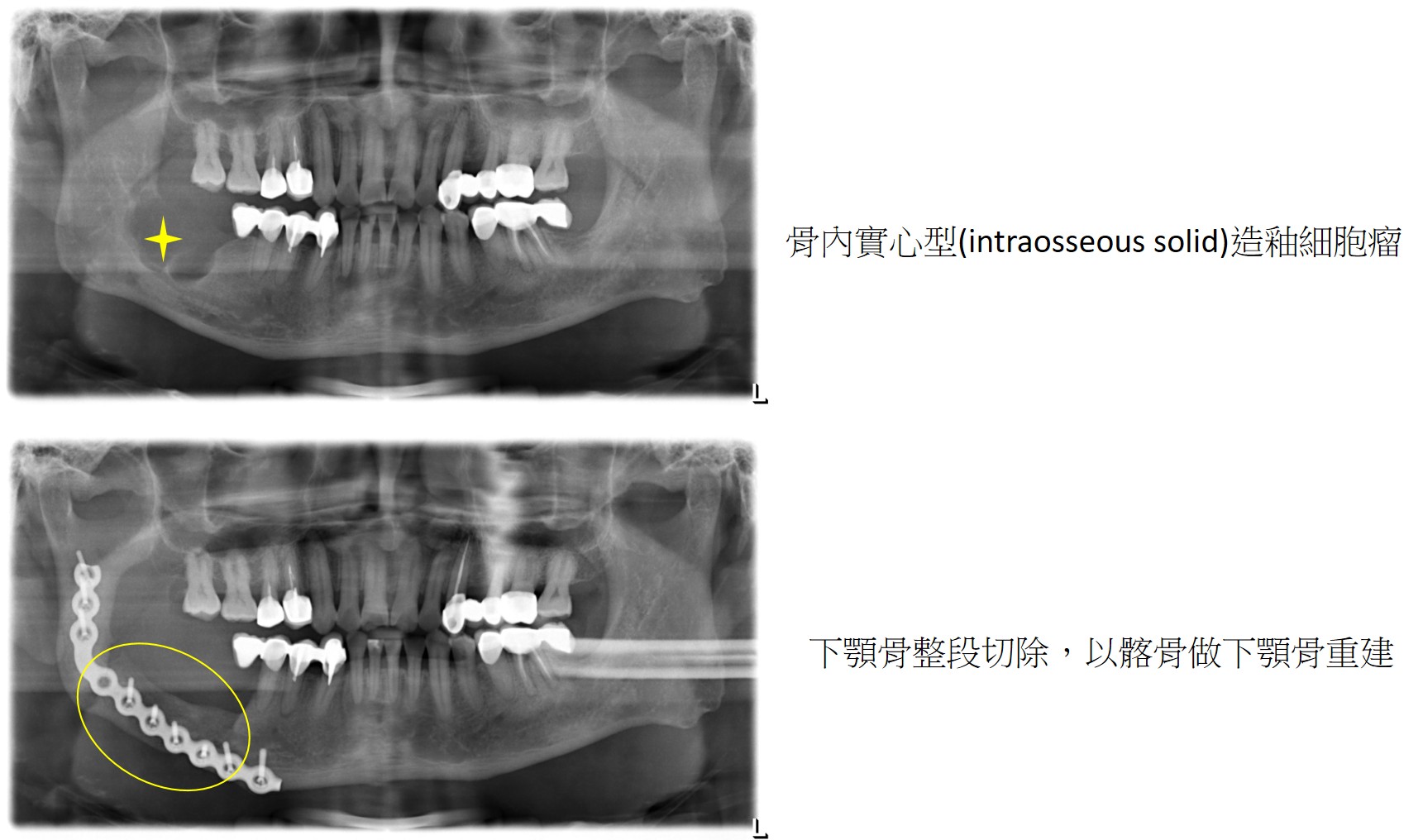 圖片2 圖片2