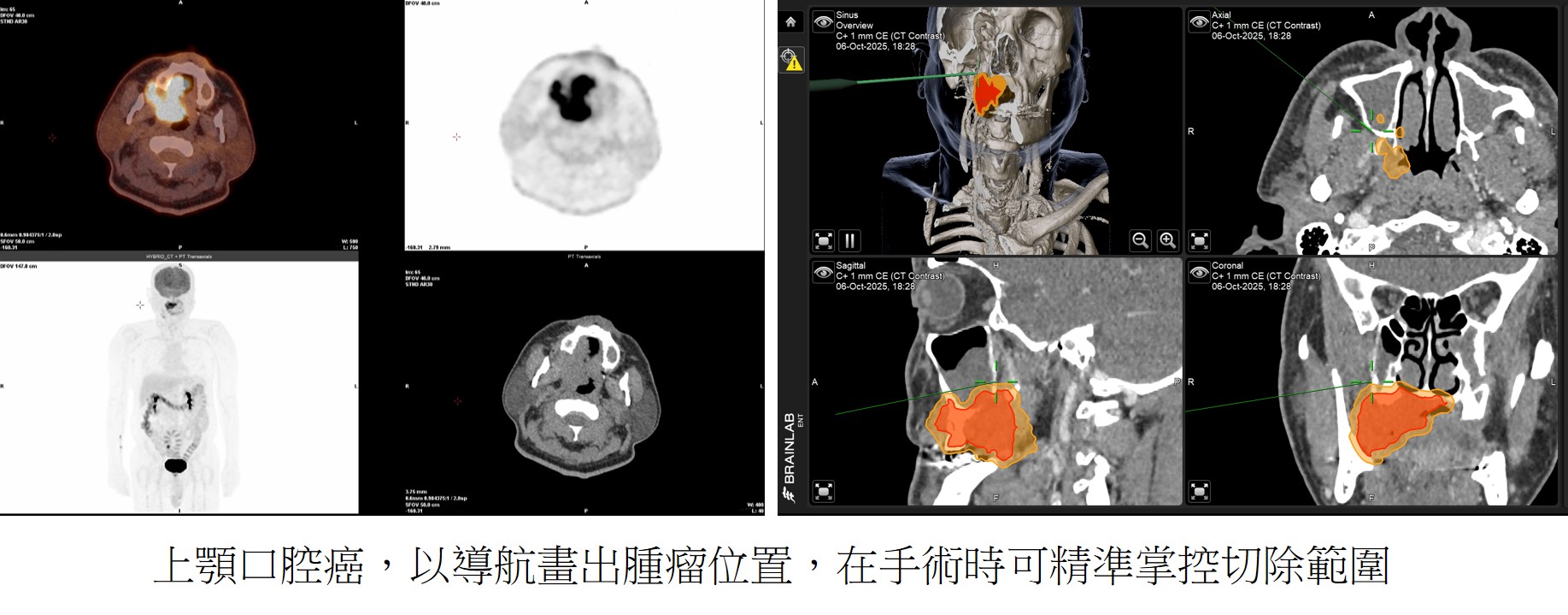 圖片4 圖片4