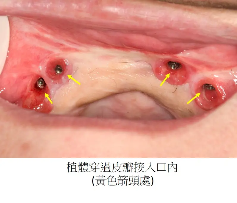 圖片3 1