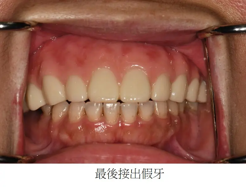 圖片4 1